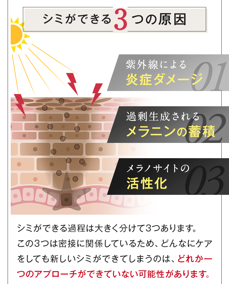 シミができる3つの原因